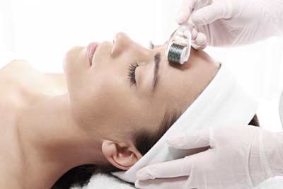 Micro-needling Paris 01