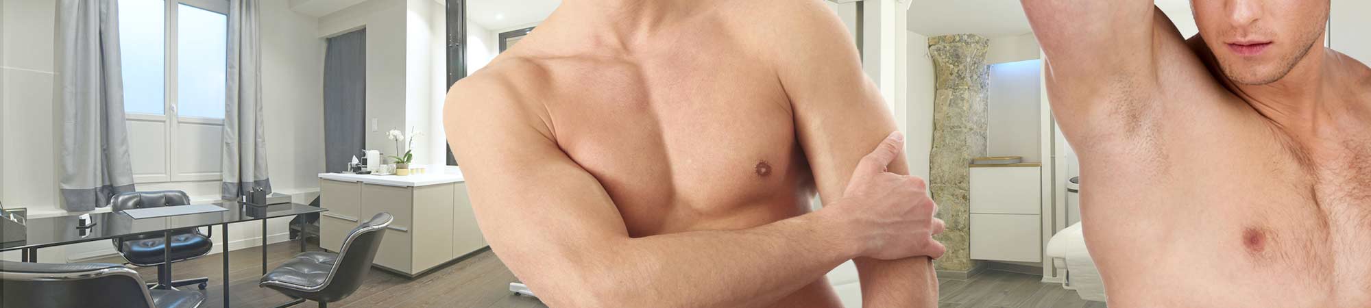 Epilation laser homme paris