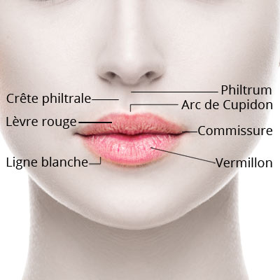 Redessiner les lèvres par l'injection d'acide hyaluronique